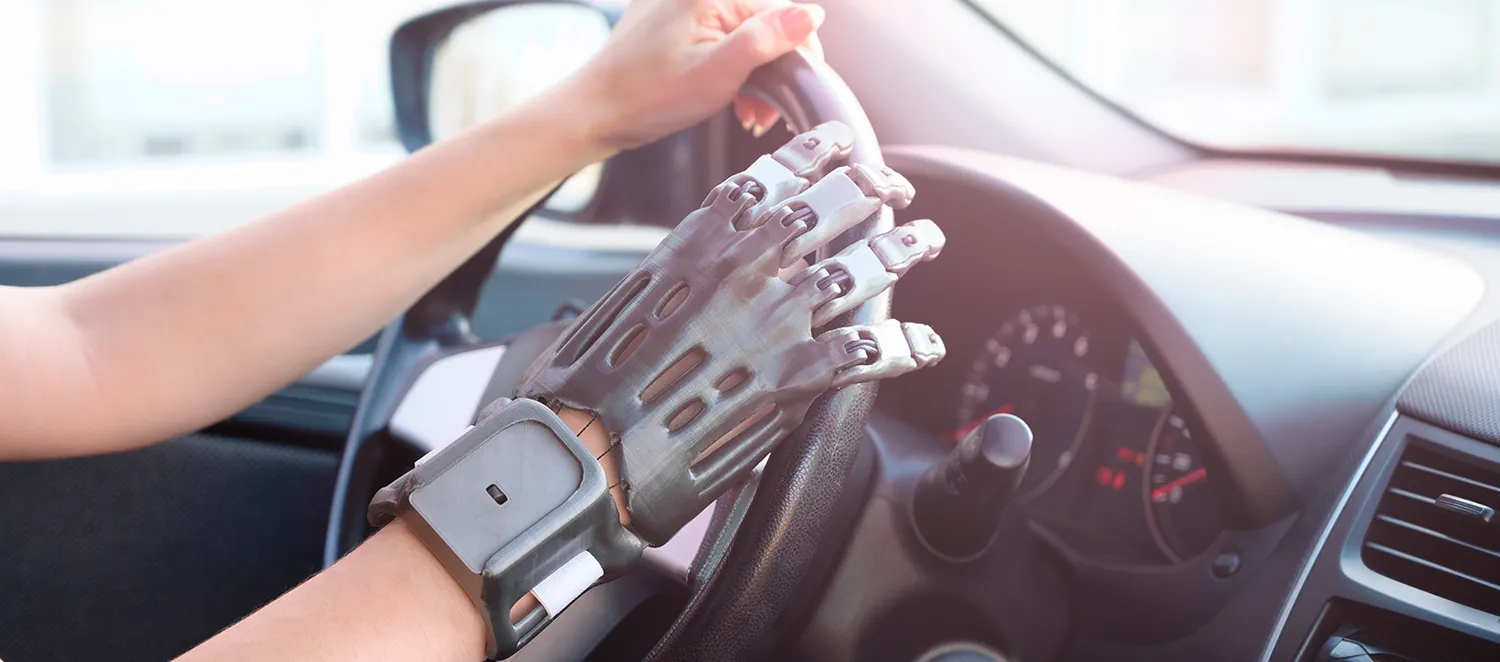 Autofahrerin mit Handprothese